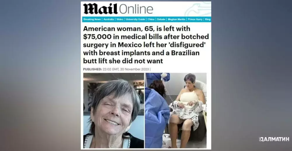 65-летняя американка сбросила вес и отправилась в Мексику, где ей за недорого должны были убрать лишнюю кожу