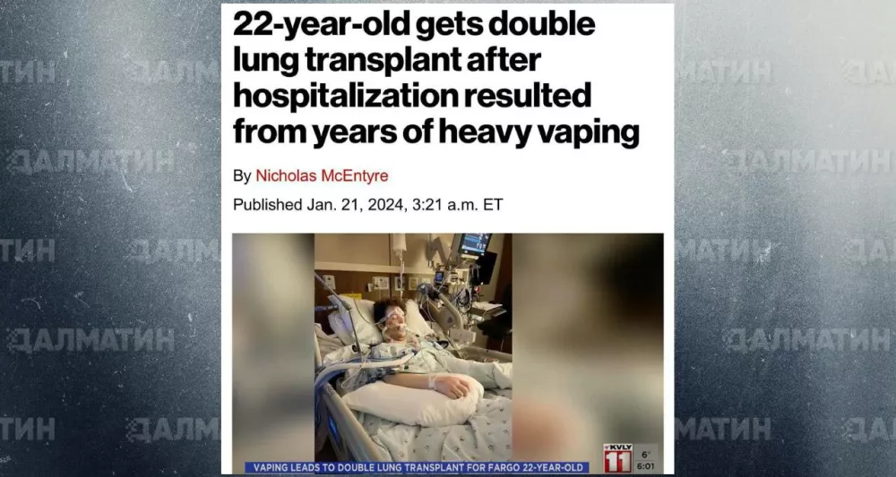 22-летнему парню пересадили оба лёгких после многолетнего курения вейпа