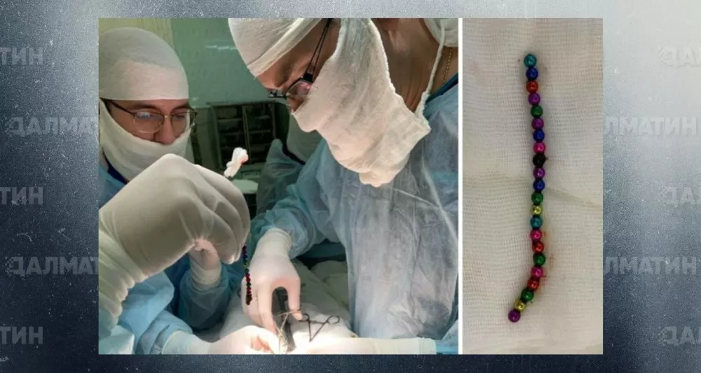 Ростовские врачи обнаружили у двух детей по 29 магнитов в кишечнике