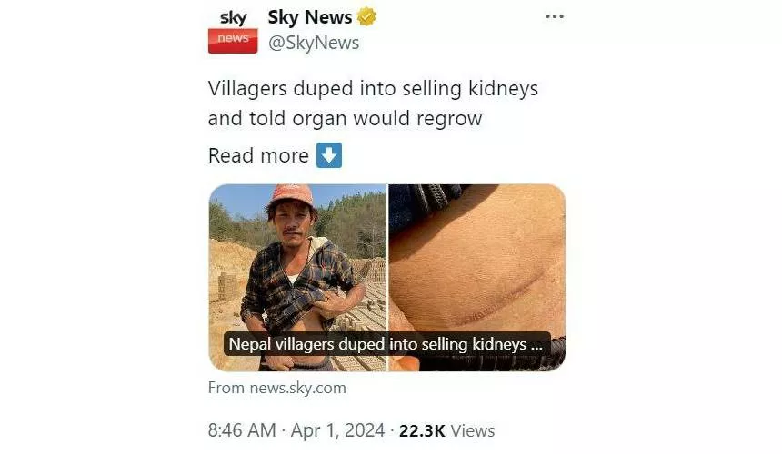 Жители Непала продают свои почки, потому что им говорят, что орган отрастет заново